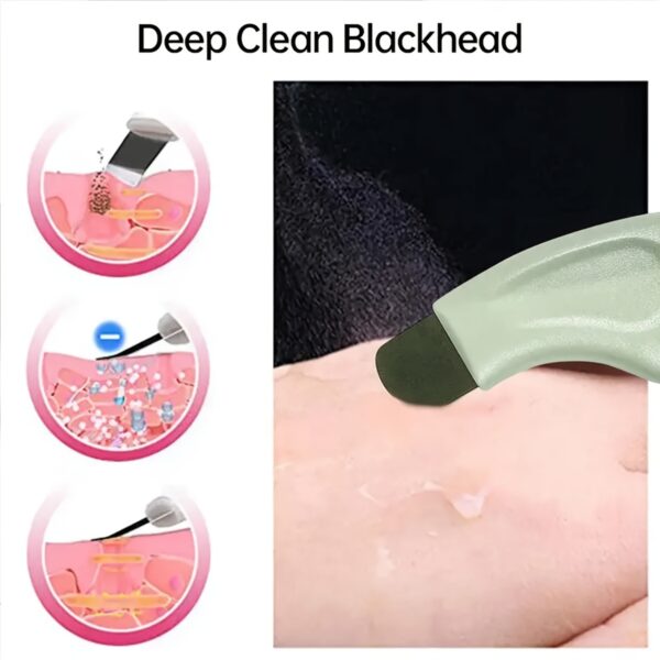 Blackhead Remover Tool Extractor Acne Removal Whitehead Popping, Removing For Nose Face Skin Scrubber Tools Beauty Care Tool - Image 5